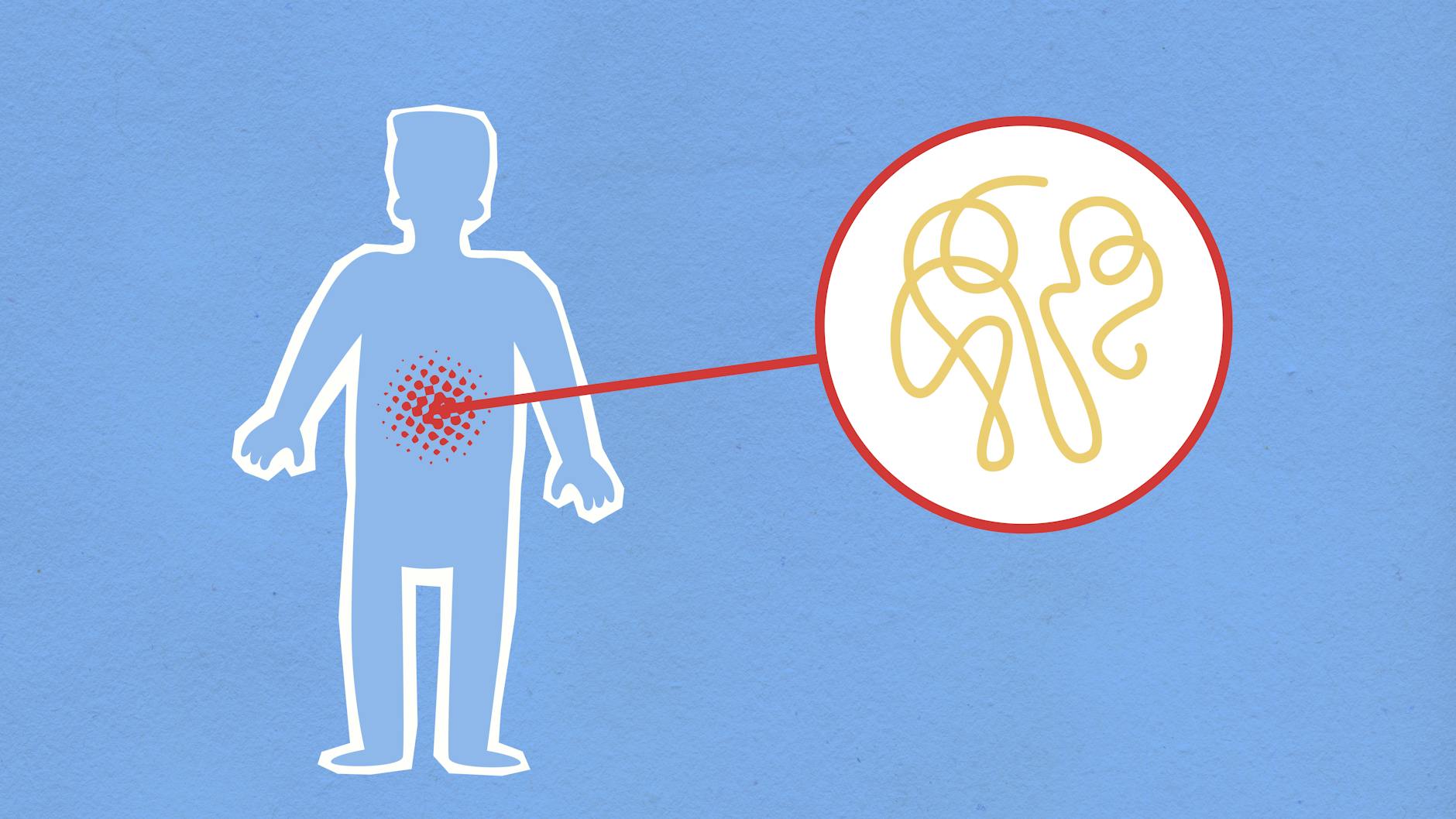Digestive Risks From Overfeeding Bananas