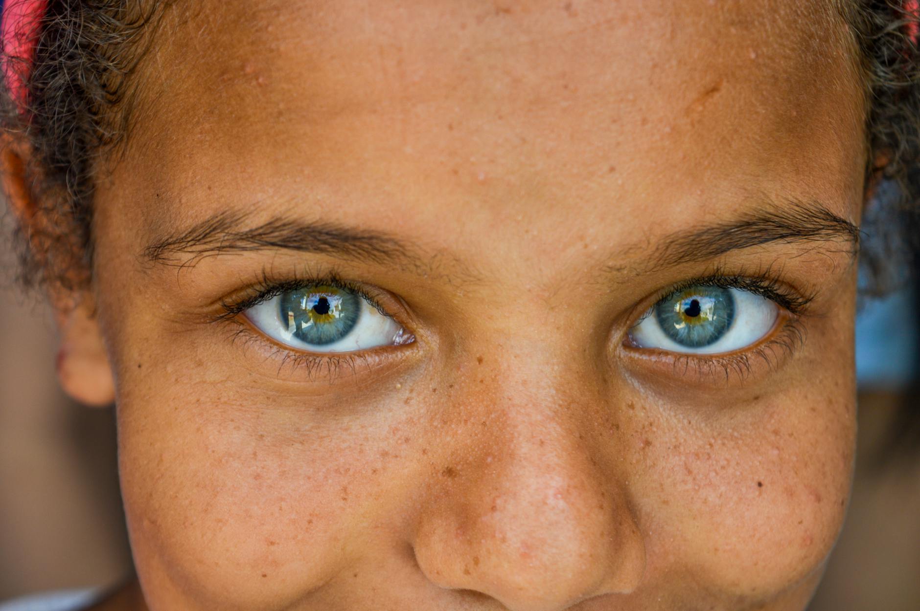 Understanding Blue Eyes in Mixed-Heritage Cat Breeds