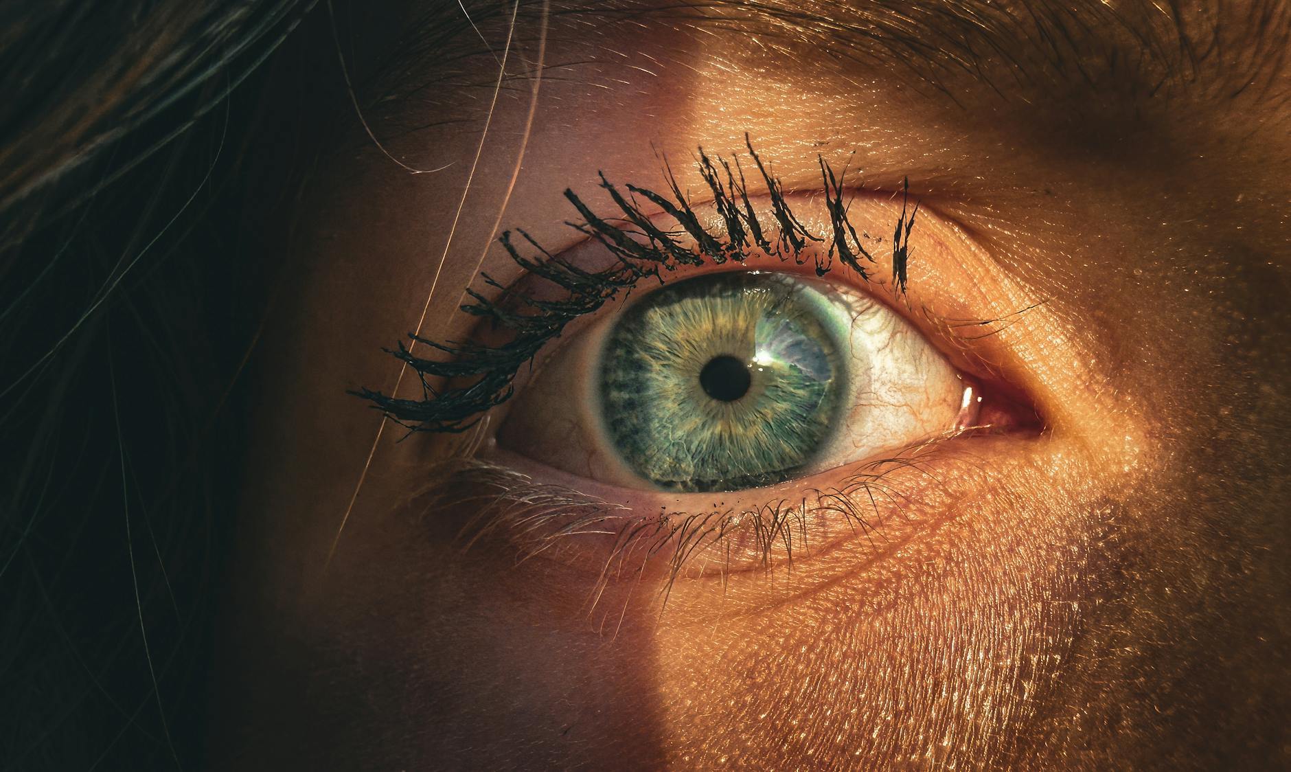 Understanding Heterochromia in Cats