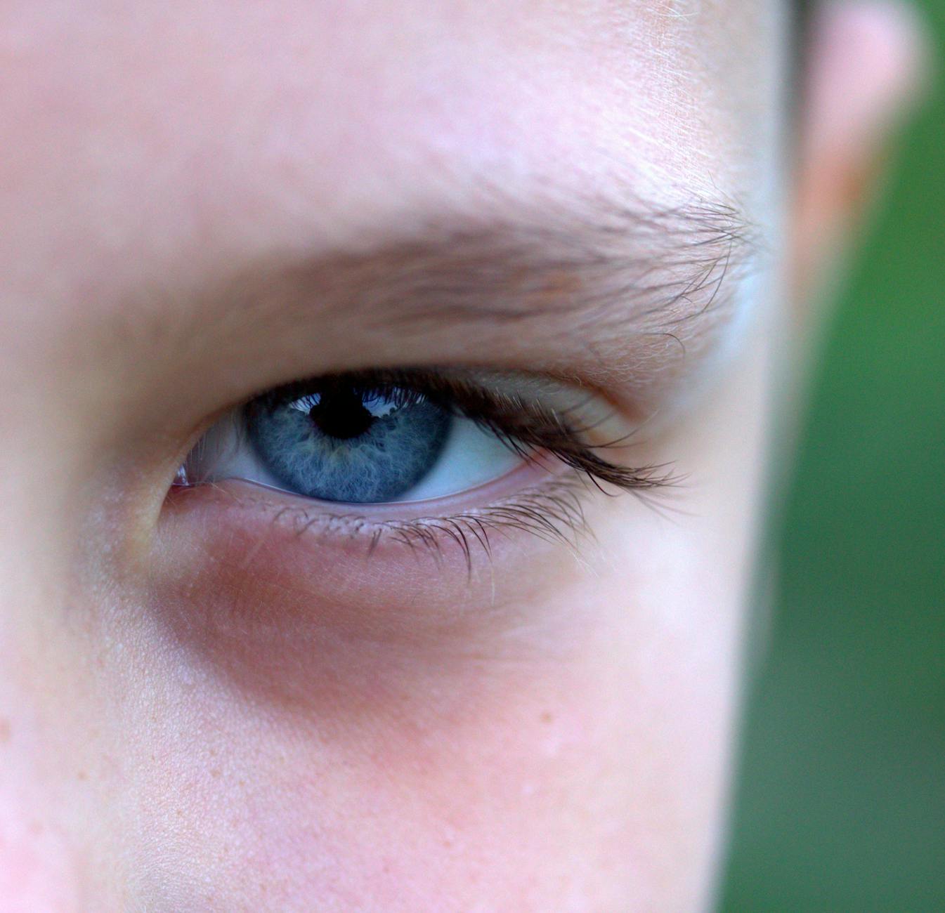 Why Do Blue-Eyed Himalayans Require More Grooming Than Other Breeds?