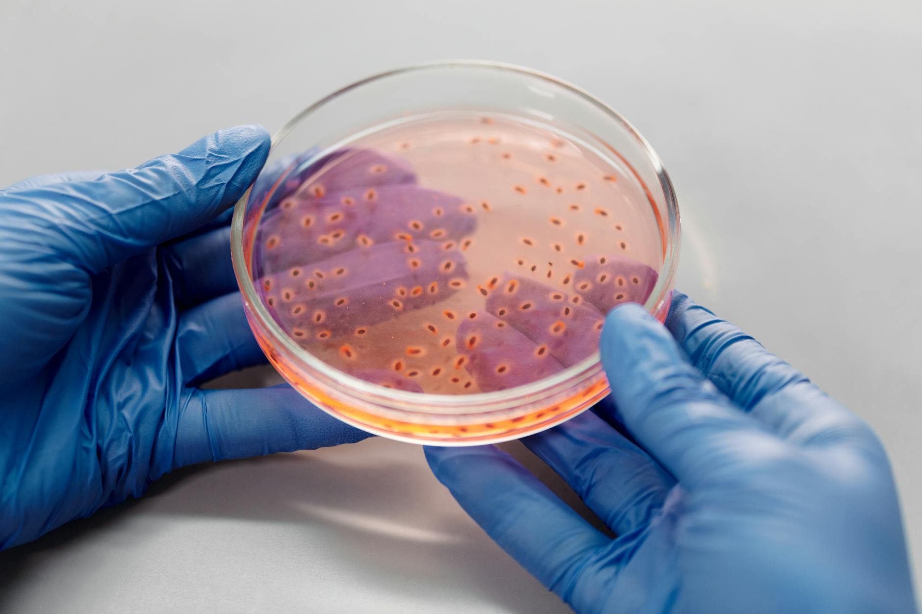 Bacteria and Pathogens in Standing Water