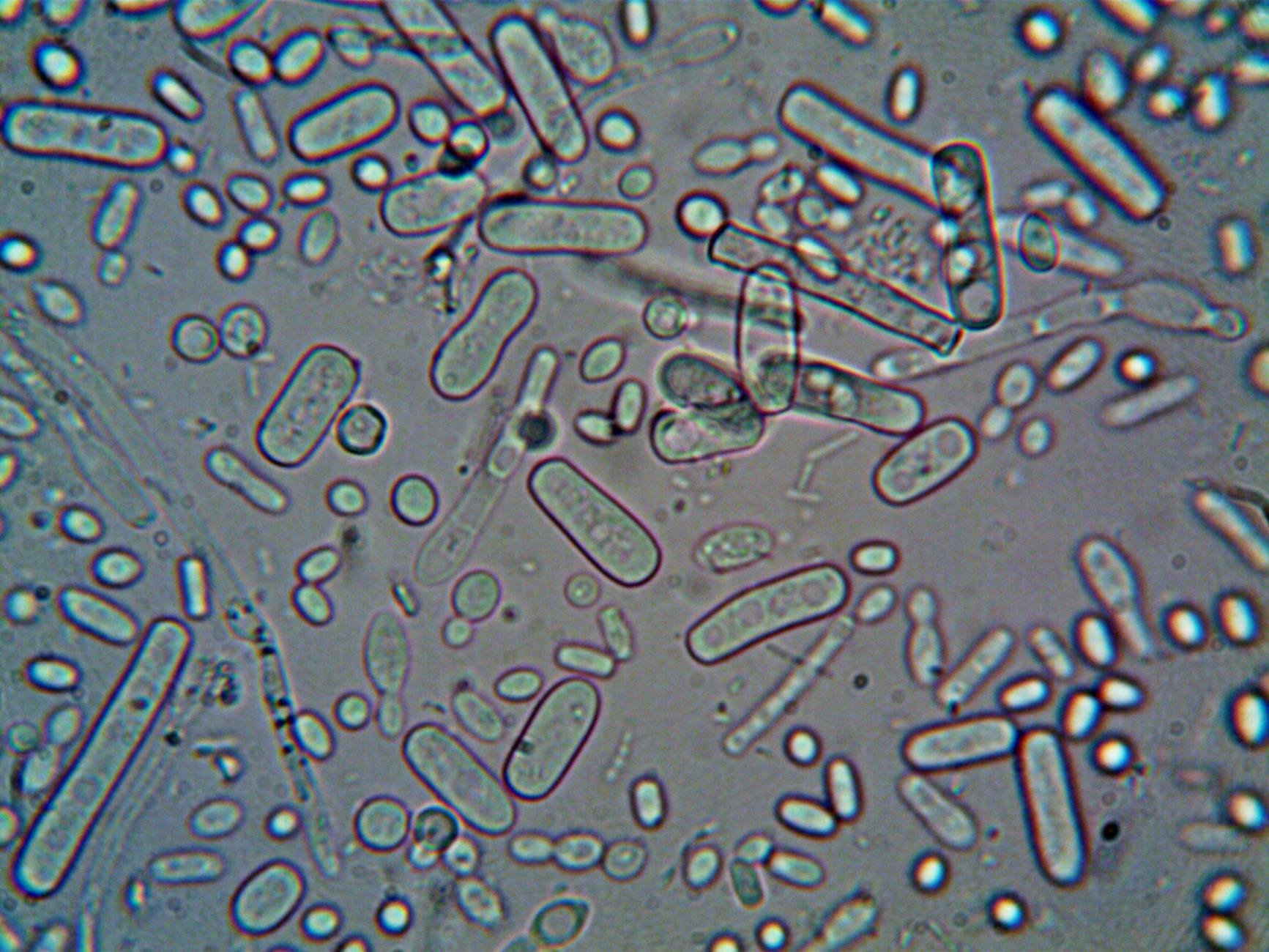 Understanding Biofilm and Bacterial Risks
