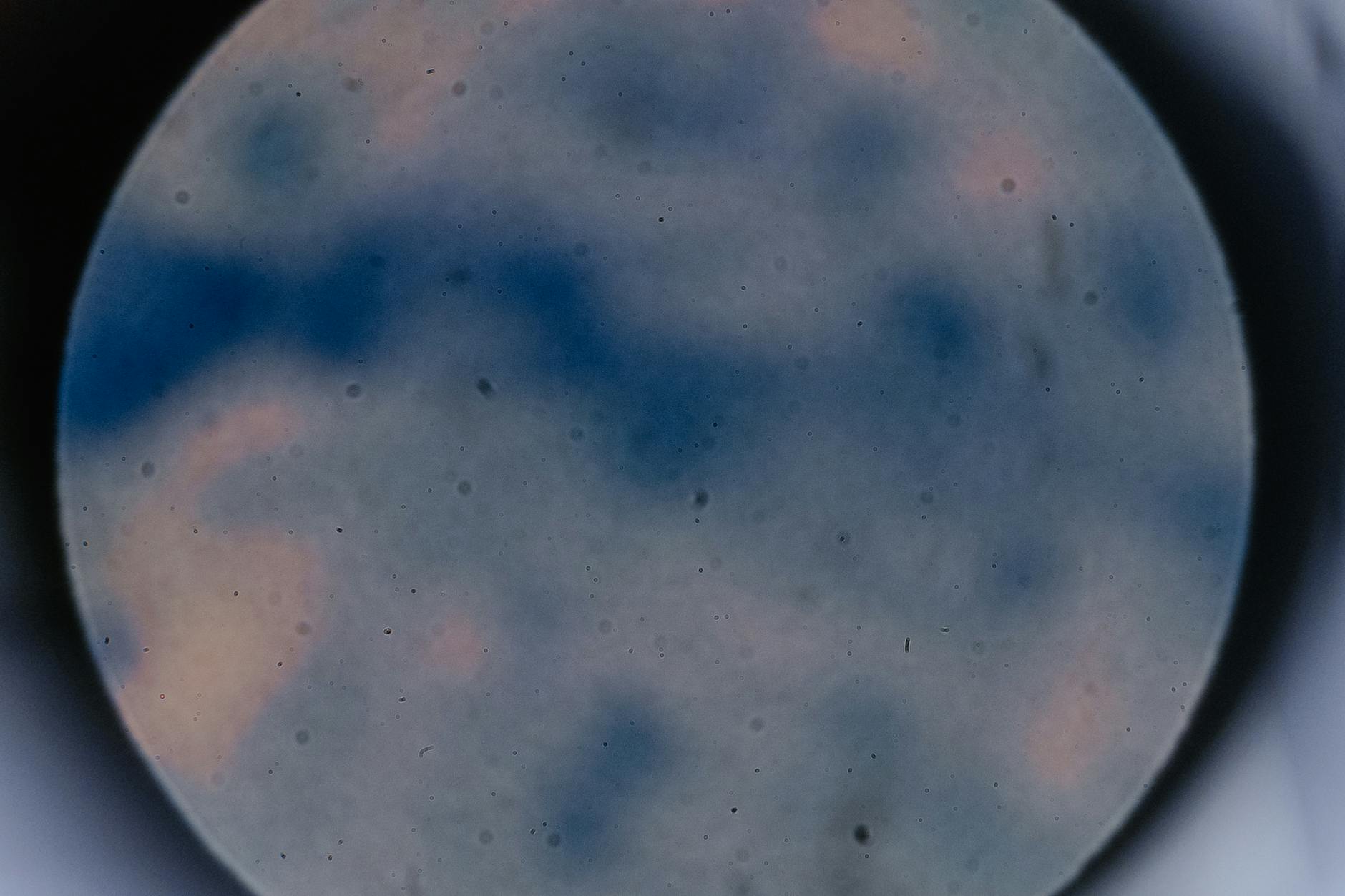 What Bacteria and Contaminants Are Actually in Toilet Water?