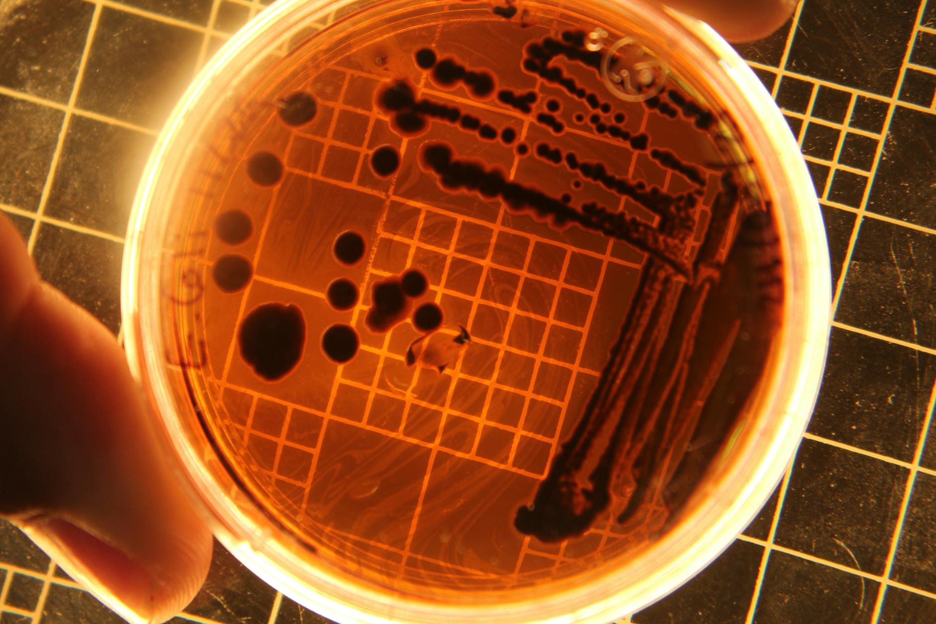 What Bacteria and Pathogens Lurk on Kitchen Floors?