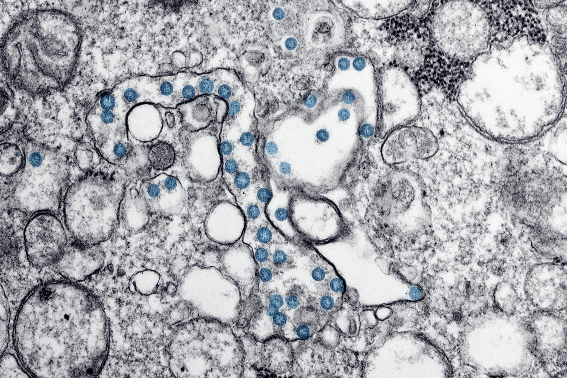 What Pathogens and Contaminants Lurk in Puddle Water?